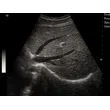 LX-BW-T5 B ULTRASOUND
