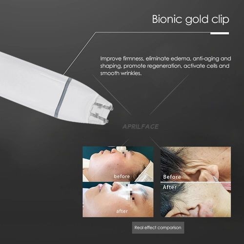 Korea  SKIN DETOX 2 IN 1 Darist Mini skin management machine 