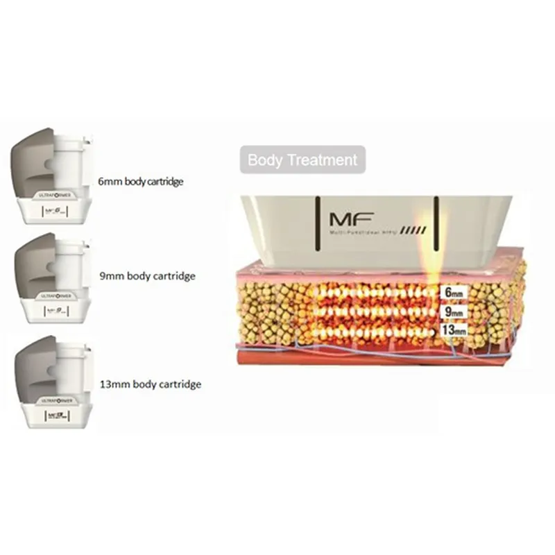7D MMFU ultrasound transducer 