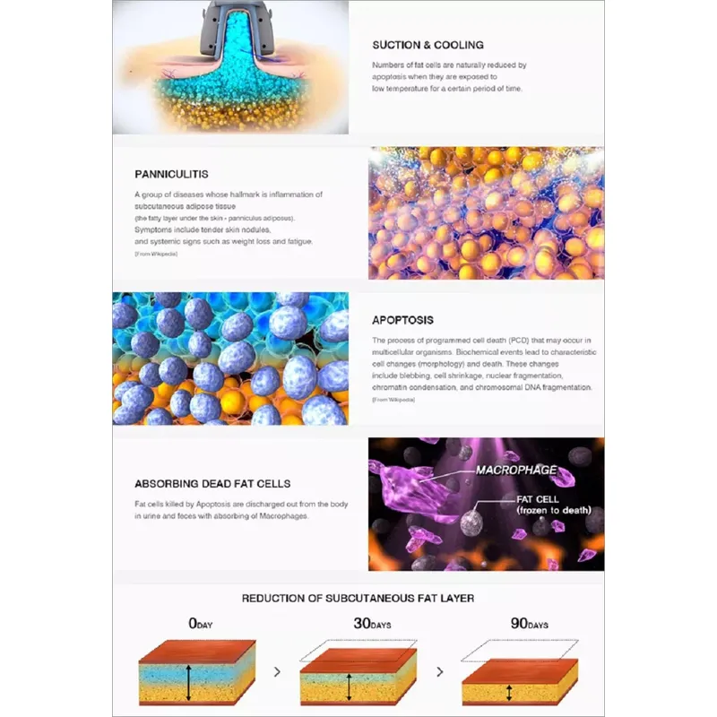 Mini cryolipolyse machine Best Portable 