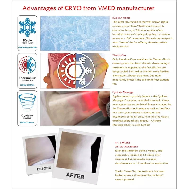 Mini cryolipolyse machine Best Portable 