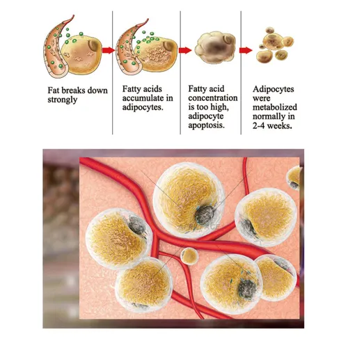 EMS Sculpt Electro Magnetic Muscle Stimulator