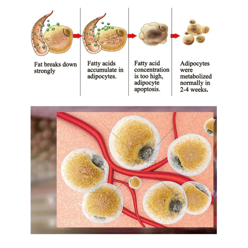 EMS Sculpt Electro Magnetic Muscle Stimulator