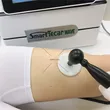 shockwave tecarterapia cet ret rf smart wave tecar machine