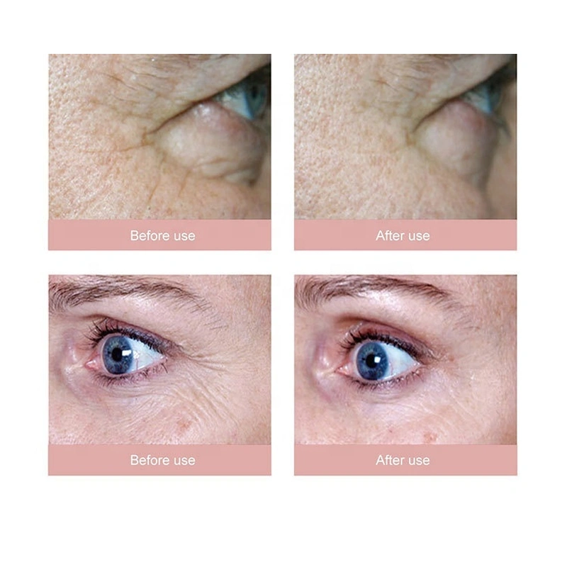 3 in 1 Ultrasonic RF Micro Electric Facial Beauty Machine 