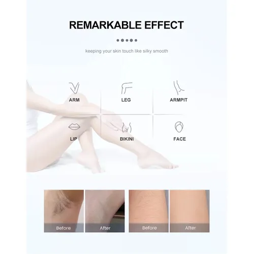 808nm diode laser hair removal device