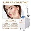 laser tattoo removal picosecond machine