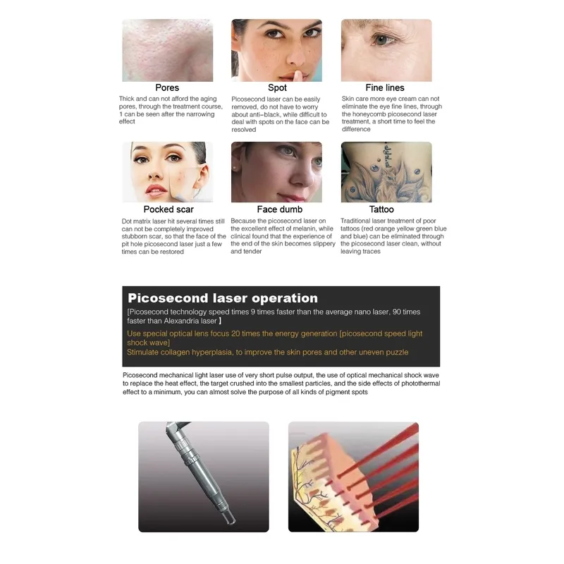 laser tattoo removal picosecond machine