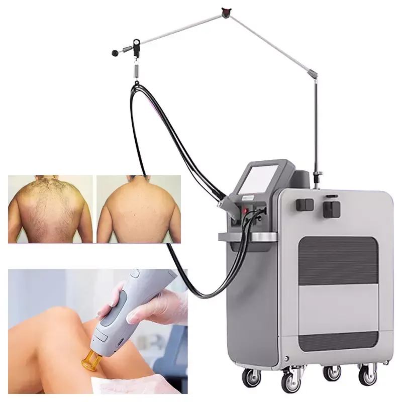 newest hair removal 755nm yag Laser depilation machine 