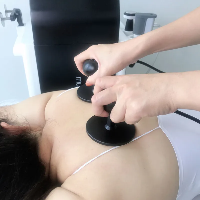 Dual 80mm Handles RET * 2 PCS accessoires 