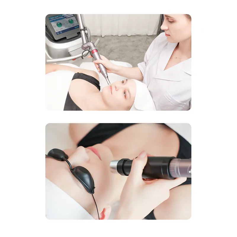 Unique Pico Laser Freckle Removal Tattoo Removal Birth Mark 