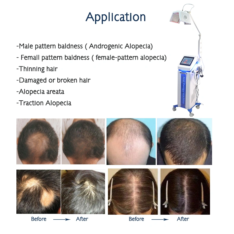 Laser hair growth machine 