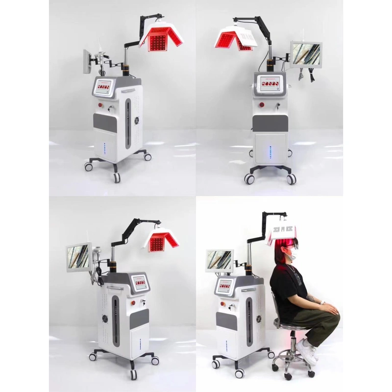  Laser hair loss treatment Hair Regrowth 