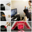 Anti-hair Loss Treatment 650nm Laser Hair Growth Treatment Machine