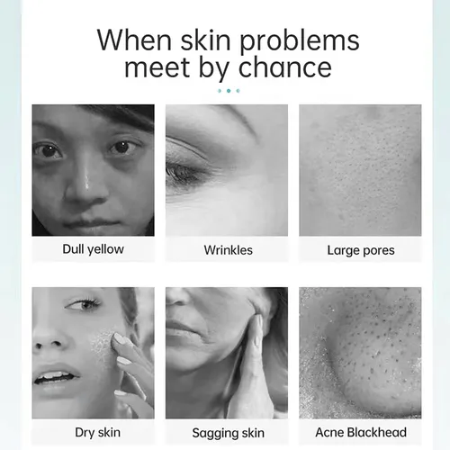 9 in 1 Rf Machine Skin Lifting Hydro Water Aqua