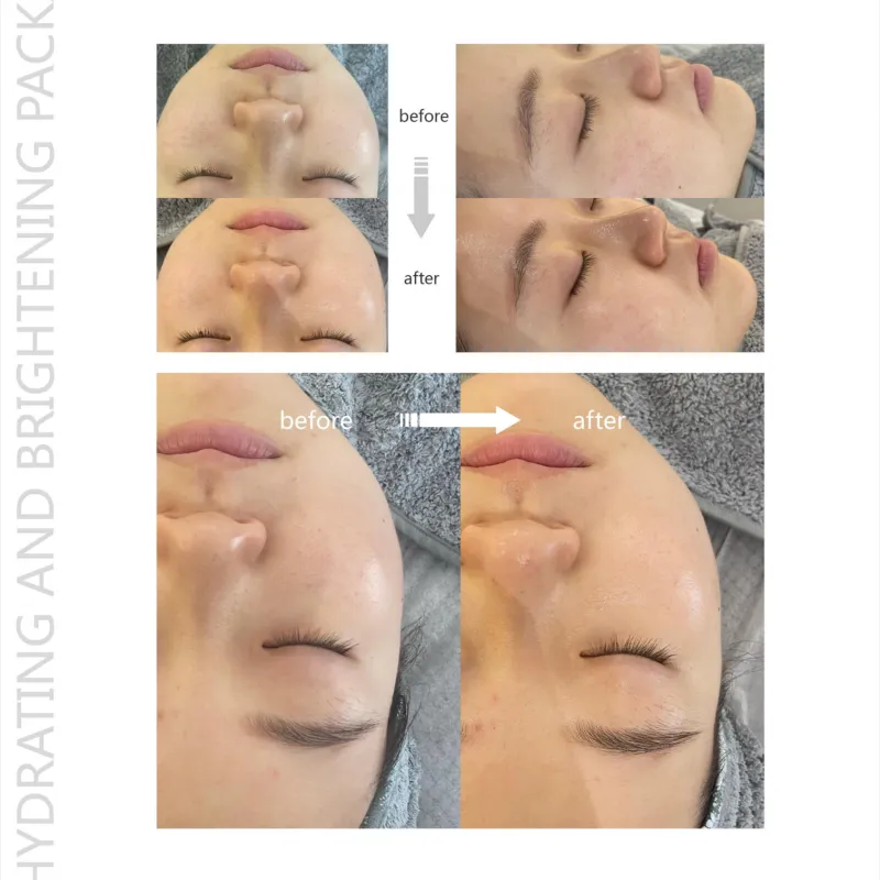 Ambertree Hydrating and brightening package