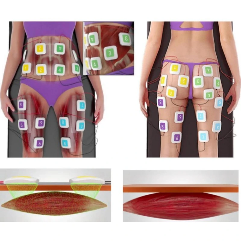 Build Muscle Burn Fat Device EMS Stimulator Elector Muscle 