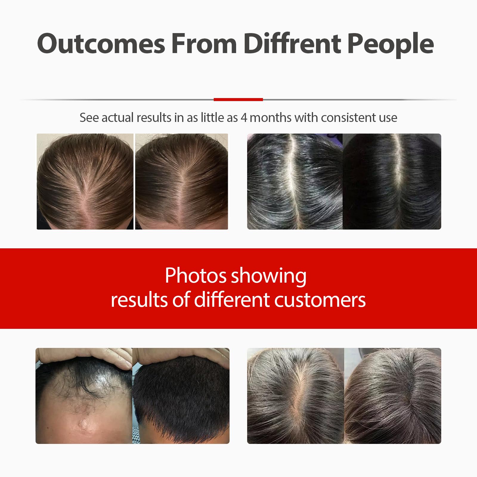 2026 Upgrade Laser Cap, Red Light Therapy for Hair Growth