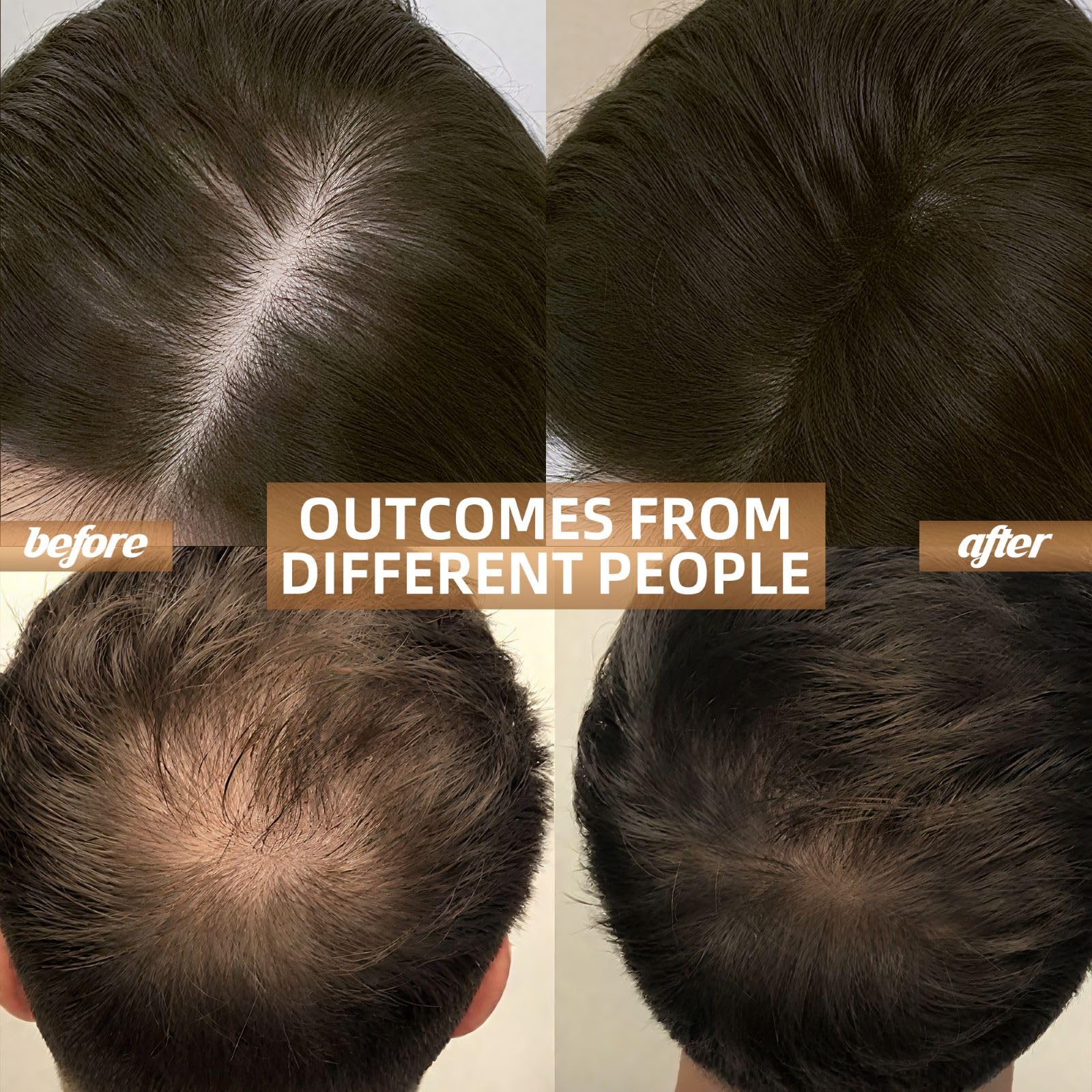 Cordless Red Light Therapy for Hair Growth Cap, Infrared Red Light Therapy to Support Scalp Health, Reduce Hair Loss & Shedding