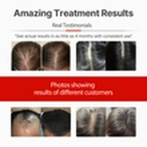 Portable Hair Growth Cap, Red Light Therapy for Hair Loss, Wireless Hat for Men & Women, with Built-in Battery & Controller