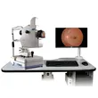 fundus retinal camera 
