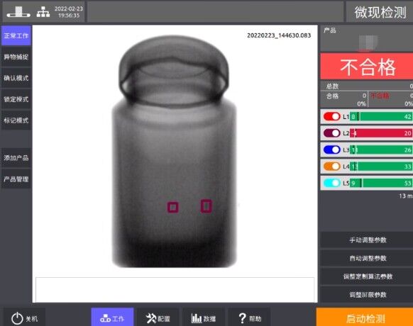 Vixdetect X-ray benefits