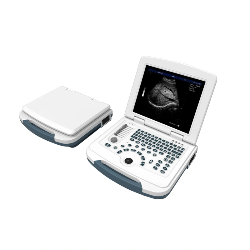 B-ultrasonic diagnostic equipment