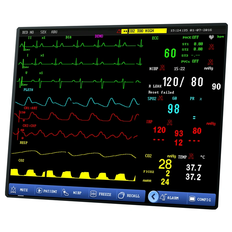 FY-8000B (PRO12) Multi-parameter Monitor