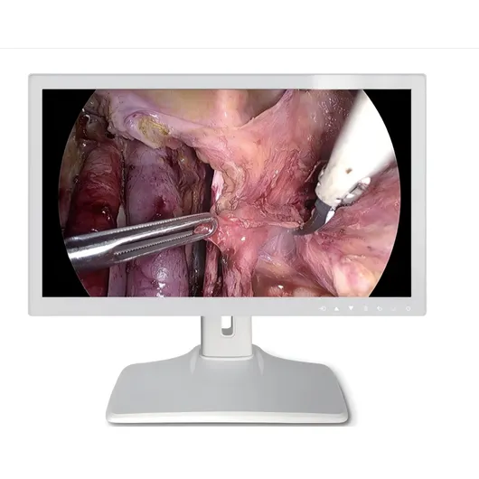 27 inch 4K Medical Display