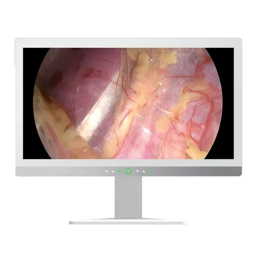 32“ 4K Ultra-high definition monitor for surgery