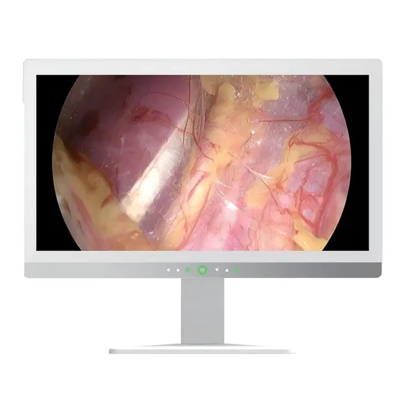 32“ 4K Ultra-high definition monitor for surgery
