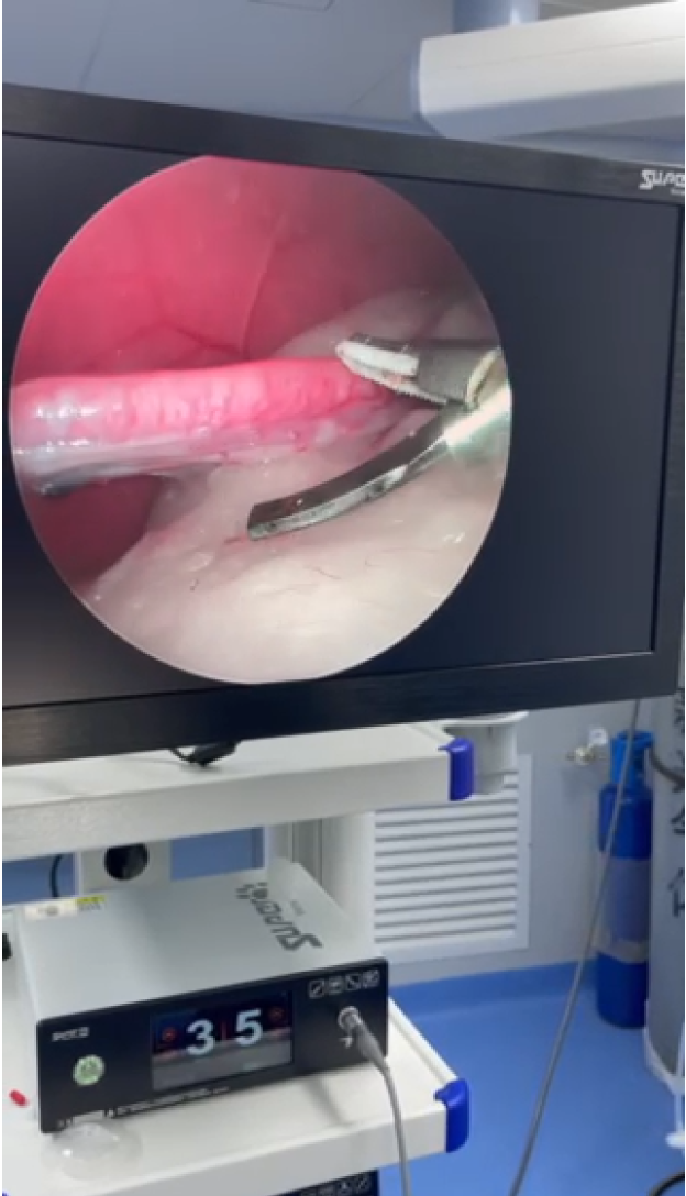 Veterinary Ultrasonic Scalpel System