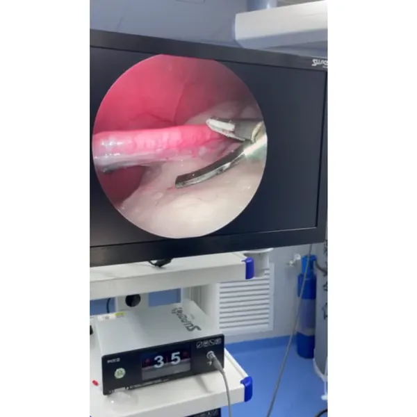 Veterinary Ultrasonic Scalpel System