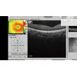 OCT-500 Optical Coherence Tomography non contact tonometer Machine 