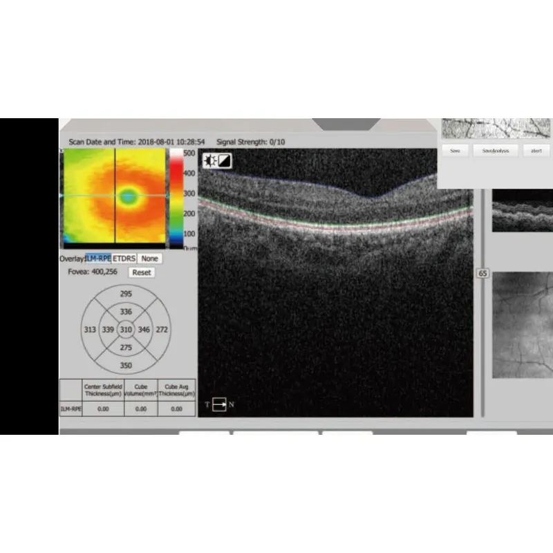 OCT-500 Optical Coherence Tomography non contact tonometer Machine 