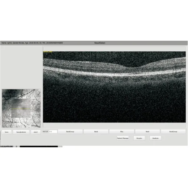 OCT-500 Optical Coherence Tomography non contact tonometer Machine 