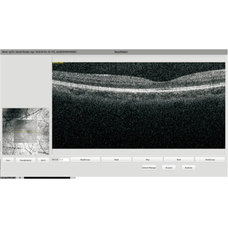OCT-500 Optical Coherence Tomography non contact tonometer Machine 
