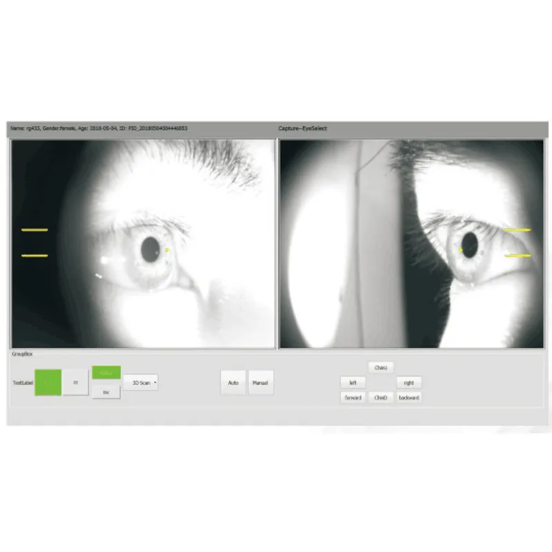 OCT-500 Optical Coherence Tomography non contact tonometer Machine 