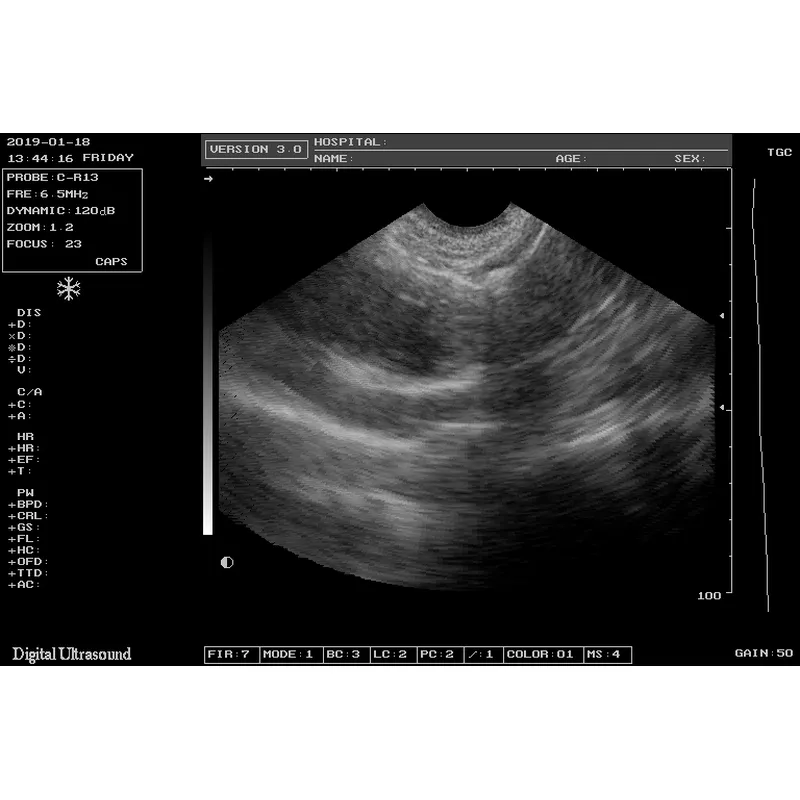 Cheapest Sedan Digital Ultrasound Machine LX-BW-L1