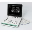 Cheapest Sedan Digital Ultrasound Machine LX-BW-L1
