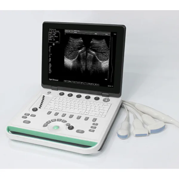 Cheapest Sedan Digital Ultrasound Machine LX-BW-L1