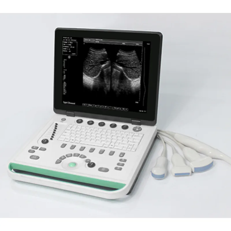 Cheapest Sedan Digital Ultrasound Machine LX-BW-L1