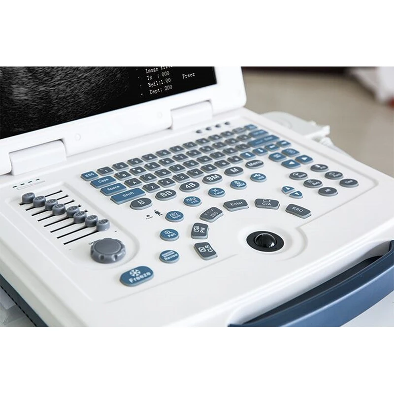 Hot sale CE Hospital Portable Black White Ultrasound machine Price  LX-BW-L2