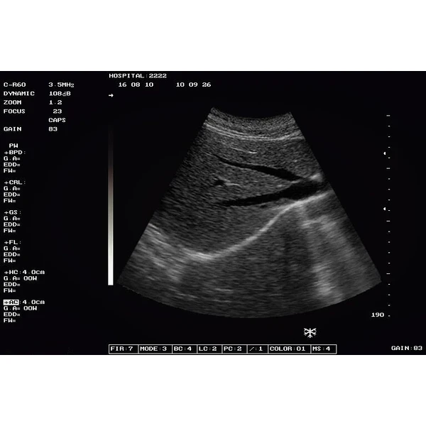 Hot sale CE Hospital Portable Black White Ultrasound machine Price  LX-BW-L2