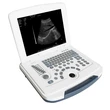 Hot sale CE Hospital Portable Black White Ultrasound machine Price  LX-BW-L2
