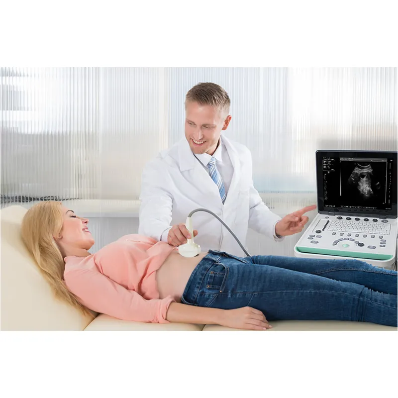 Cheapest Sedan Digital Ultrasound Machine LX-BW-L1