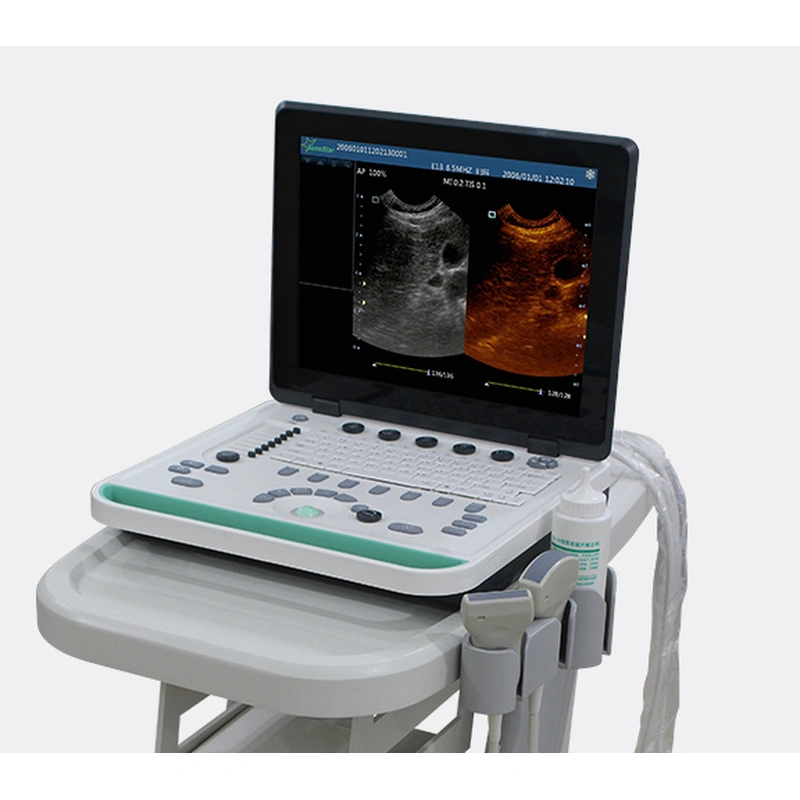 Portable Veterinary Light Weight Ultrasound 7.5MHz Linear Probe  LX-BW-L3 B ULTRASOUND
