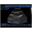 Portable Veterinary Light Weight Ultrasound 7.5MHz Linear Probe  LX-BW-L3 B ULTRASOUND
