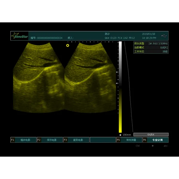 Portable Veterinary Light Weight Ultrasound 7.5MHz Linear Probe  LX-BW-L3 B ULTRASOUND