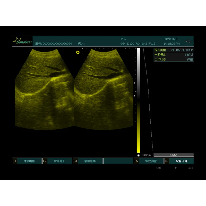 Portable Veterinary Light Weight Ultrasound 7.5MHz Linear Probe  LX-BW-L3 B ULTRASOUND